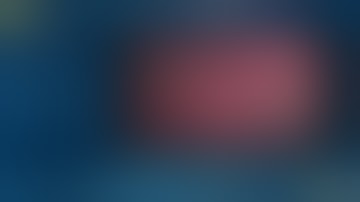 Remnant Cholecystectomy with ICG Infrared Cholangiography