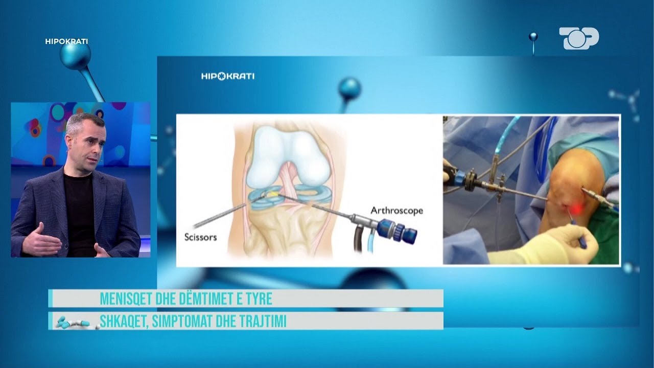 Keni dëmtuar ligamentin? Kjo është koha që ju duhet për rikuperim - Hipokrati