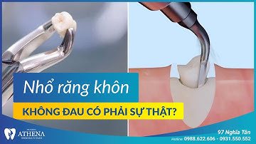 Nhổ răng khôn không đau có phải sự thật ? | Nha khoa Athena