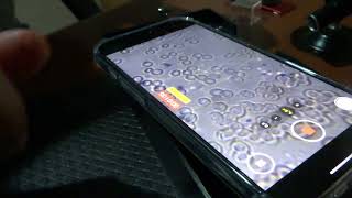 Fresh Human Blood With Diple Black Lens And Iphone