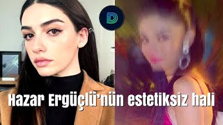 Alev Alev Dizisinin Yıldızı Hazar Ergüçlünün Estetiksiz Hali Ortaya Çıktı