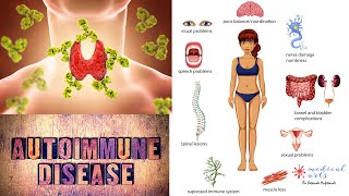 What Are Autoimmune Diseases?