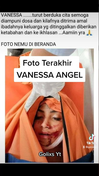 VANESSA ANGEL Foto Di Rumah Sakit