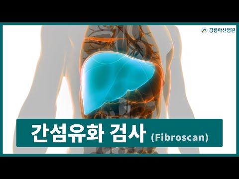 간섬유화 검사 (Fibroscan)