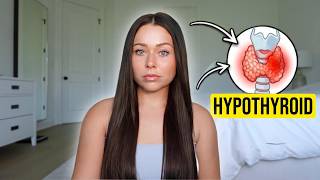 I Was Diagnosed With Hashimotos