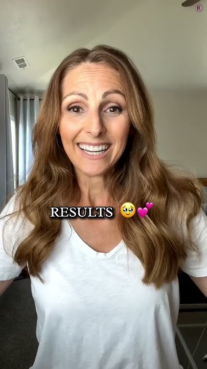  Why No One Talks About This Instant Thin Hair Fix! #HairCare # ...