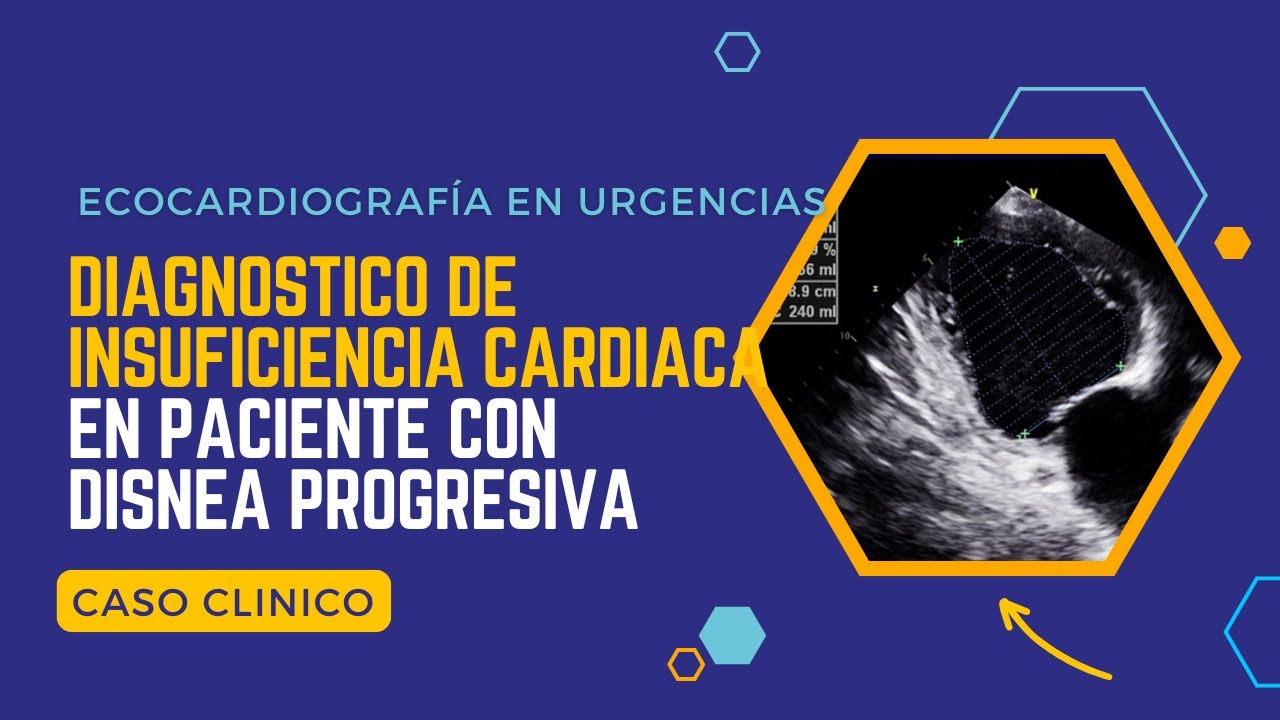 ✅ECOCARDIOGRAMA EN URGENCIAS: Diagnóstico de INSUFICIENCIA CARDIACA en un paciente con DISNEA🔎