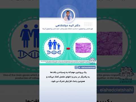 با سندرم نرمی مفاصل بیشتر آشنا شوید