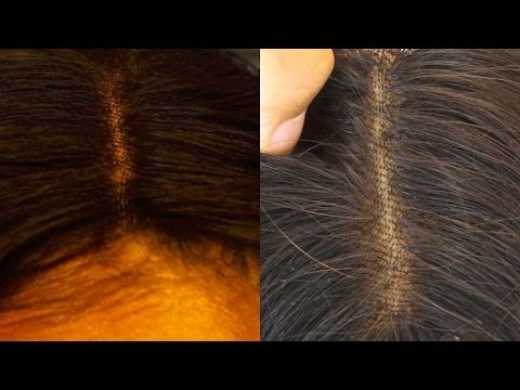 How To: Natural Looking Lace Closure (NO BLEACH, NO CONCEALER)