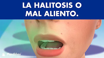 ¿Cuáles son los tres problemas de salud o higiene de los que puede ser síntoma la halitosis?