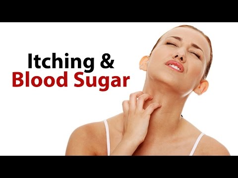 itching-&-blood-sugar