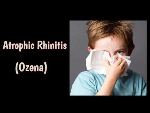 Atrophic Rhinitis || Ozena || CHRONIC RHINITIS-3