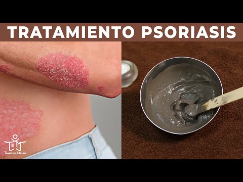 Video: 3 formas de nadar con psoriasis