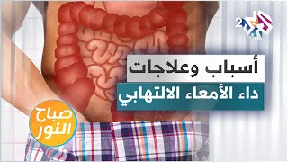 داء الأمعاء الالتهابي .. الأنواع والأسباب والعلاجات