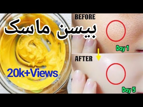 Gram Flour Skin Whitening Remedy By KWNA|Besan Face Pack For Glowing|Face Pack for Whitening