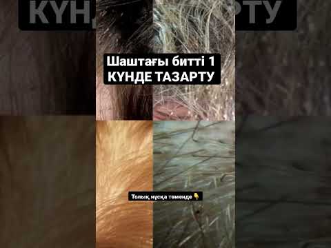 Бейне: Бір күнде күйдірілген калорияларды қалай есептеу керек: 7 қадам (суреттермен)