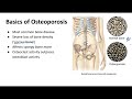 Aging Effects on Bone and Osteoporosis