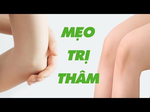 MẸO TRỊ THÂM ĐẦU GỐI VÀ KHUỶU TAY CHO CÁC NÀNG