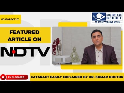 Cataract Easily Explained