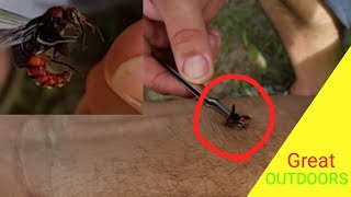 FLYING COW KILLER STING TEST. The Velvet Ant.