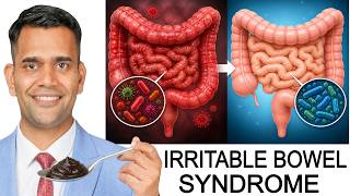 IBS Relief in 24 Hours (Works Fast) | End IBS Symptoms Fast (Natural Relief )