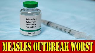 New alert: 940 confirmed cases of measles this year | US NEWS