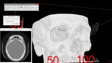 3D viewing of CT / MRT data using Fiji / ImageJ
