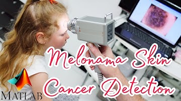 Melanoma Skin Cancer Detection Using BPNN with ABCD Features | Latest Matlab - Final Year Projects