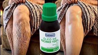 ANY TYPE OF SAGGY SKIN, VARICOSE VEINS, AND SPOTS DISAPPEAR By Dabbing This on at Night.. ANY TYPE OF SAGGY SKIN, VARICOSE VEINS, AND SPOTS DISAPPEAR By Dabbing This on at Night..