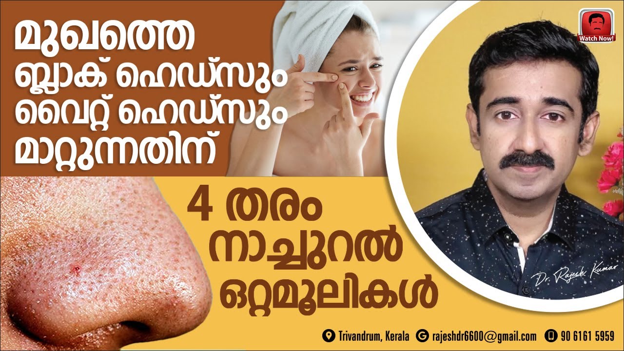 മുഖത്തെ ബ്ലാക് ഹെഡ്‍സും വൈറ്റ് ഹെഡ്‍സും മാറ്റുന്നതിന് 4 തരം നാച്ചുറൽ ഒറ്റമൂലികൾ..
