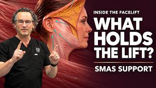 Inside the Facelift: SMAS Support, Sutures & Skin Closure