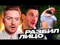 Разбил лицо - Беременный папа | 4 ВЫПУСК