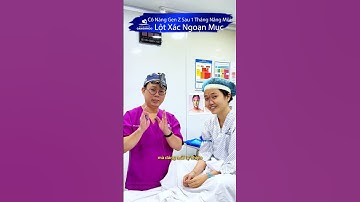 Cô Nàng Gen Z Sau 1 Tháng Nâng Mũi – Lột Xác Ngoạn Mục Khiến Ai Cũng Hết Hồn! #short  #nangmui #mui