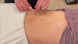 C-section Scar Mobility: Skin Rolling