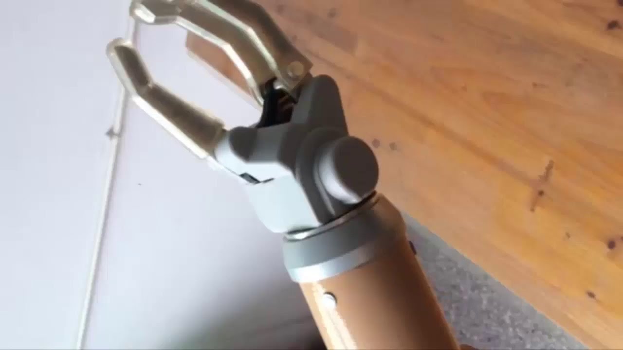 Robotic Arm Prosthetic Review From Asia