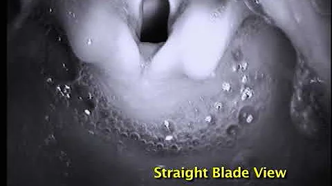 7-29.  Larygoscopes - Curved vs. Straight Blades