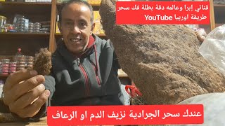 عندك سحر الجراية نزيف دم أو الرعاف لوبر أو جلد الابل الجمال بخري ودعيلي