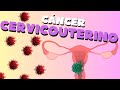 ¿Qué es el cáncer cervicouterino?