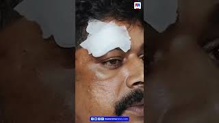 വിവാഹം മുടക്കിയെന്ന് തെറ്റിദ്ധാരണ; ഓട്ടോ ഡ്രൈവർക്കും ഭാര്യക്കും നേരെ ക്വട്ടേഷൻ ആക്രമണം #Kozhikode