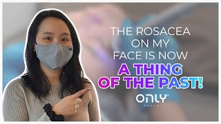 Redness Is No Longer A Concern To Me! | OnlyRosacea | Only Aesthetics