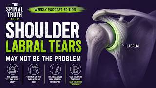 Your Shoulder Labral Tear May Not Be the Problem