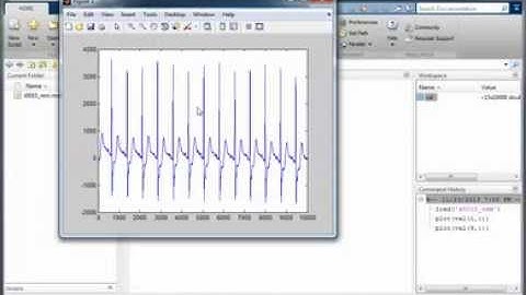 Video1-(ECG Signal) Where could you find and how can load that in MATLAB
