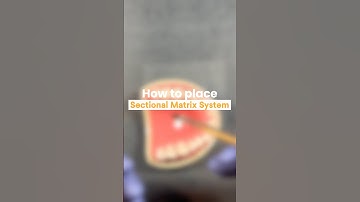 Hoe plaats je een sectioneel matrixsysteem? Gebruik code SO25METAORG voor 10% korting op de Strat...