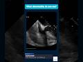 Post Op Shock | Rescue TOE Case — What Is the Diagnosis?