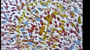 Jharna-Kala in United Nations