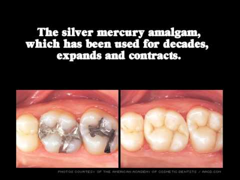 AACD Tips On How To Reverse Effects Of Aging On Your Smile
