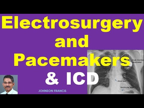 वीडियो: क्या आप पेसमेकर के साथ इलेक्ट्रोकॉटरी का उपयोग कर सकते हैं?