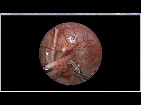 Video: Imperforate Anus менен төрөлгөн мышык хирургия жасоо үчүн
