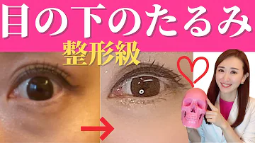 تحميل 死ぬほど変わる 目の下 Mp4 Mp3 تحميل 死ぬほど変わる 目の下 Mp4 Mp3
