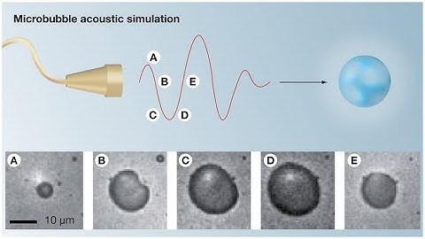 MICROBUBBLE CONTRAST AGENTS part 2